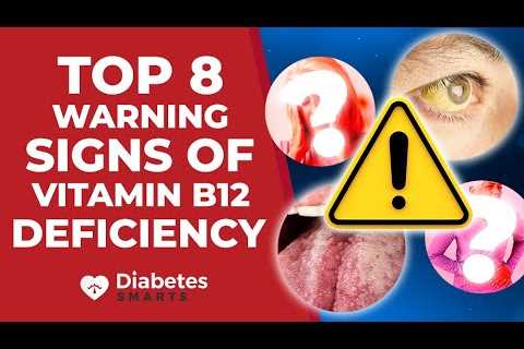 Top 8 Warning Signs Of Vitamin B12 Deficiency... And In Which Foods Can It Be Found?