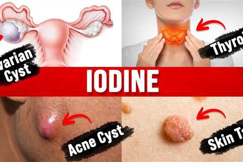 8 Unexpected Benefits of Iodine (MUST WATCH)