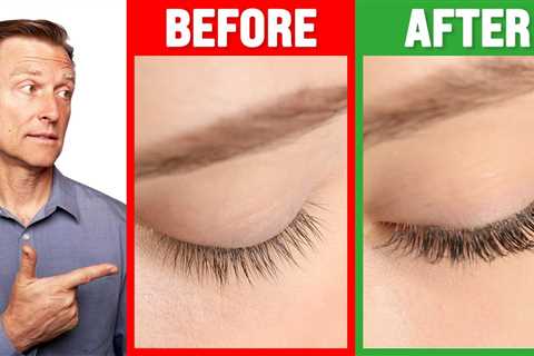 How to Grow Long Thick Eyelashes QUICKLY! - Dr. Berg