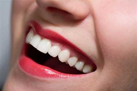 Repair Receding Gums Naturally on Strikingly