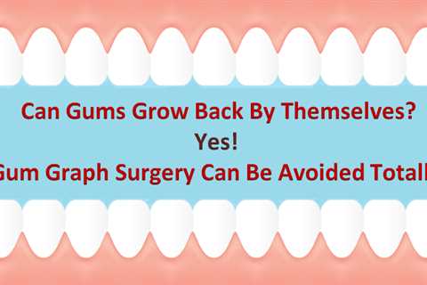 Do Gums Grow Back With Home Remedies? — Dr. Stella Halligan — Medium