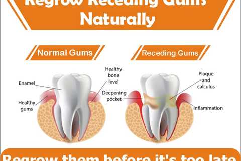 Most Effective Remedies To Regrow Receding Gums Naturally