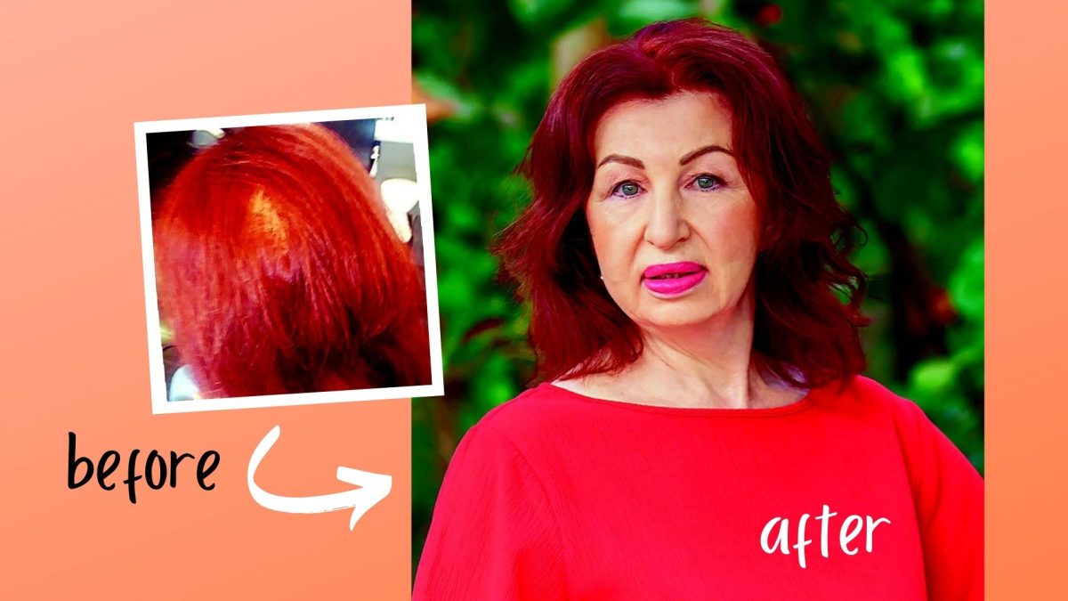 'This $20 Supplement Reversed My Hair Loss!'
