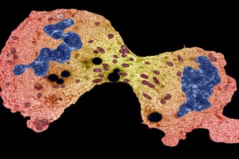 What is sarcoma and what is the survival rate of the cancer?