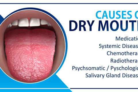 What makes dry mouth go away