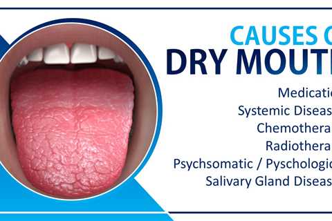 dry mouth relief natural