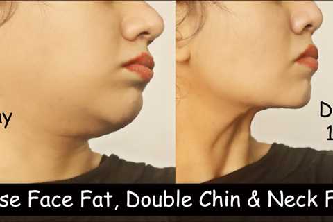 How to Lose Neck Fat and Sculpt Your Neck