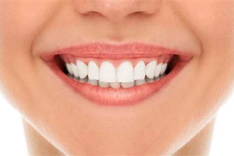 4 Natural Remedies to Repair Receding Gums - POSITIVELY GOOD