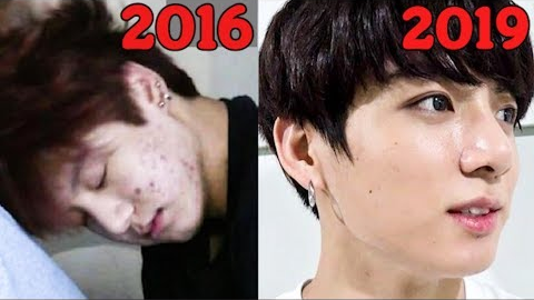 Jungkook’s Secret Skin Care Tips! You should try THIS for your Skin!