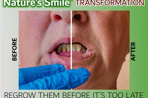 Dental Pro 7 Regrow Gums