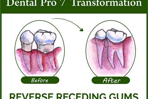Dental Pro 7 Help With Loose Teeth