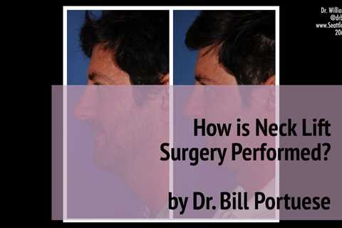 How is Neck Lift Surgery Performed? (Turkey Neck) by Dr. William Portuese  👨‍⚕️ | Seattle WA