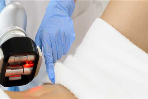 What is laser lipo cavitation?