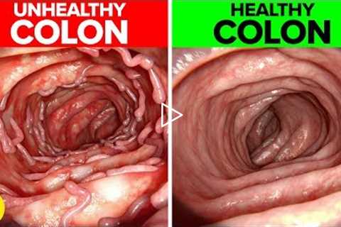 14 Effective Ways You Can Maintain A Healthy Colon