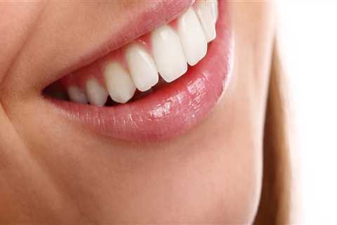 What is the best way to get perfect teeth?