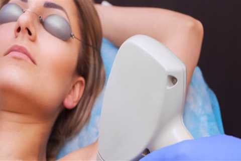 Who does laser hair removal work for?