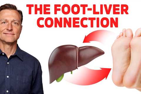 12 Things Your Feet Can Tell You About Your Liver