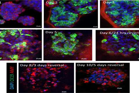 Incredible scans reveal how new drugs reverse deadliest cancer for first time