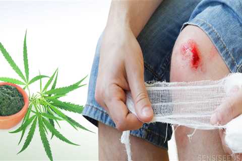 Is cbd good for wounds?