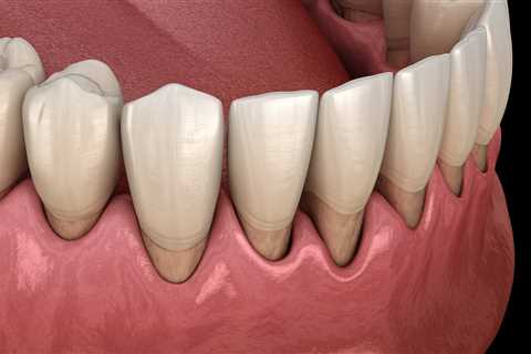 The Dangers of Gum Disease | Daniel N. Galaif, D.D.S. | Encino Dentist | (818) 789-6789