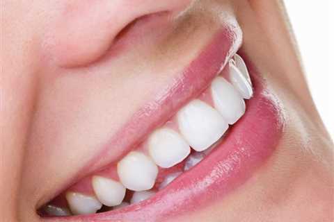 Can 70 Year Old Teeth Be Whitened? - Buznit