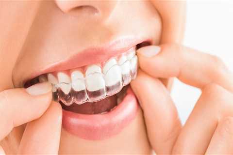 Choosing the Right Invisalign Dentist: 5 Factors to Consider
