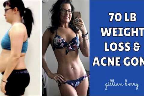 RAW VEGAN BEFORE & AFTER TRANSFORMATION: 70LB WEIGHT LOSS, ACNE GONE | LISSA RAW FOOD ROMANCE