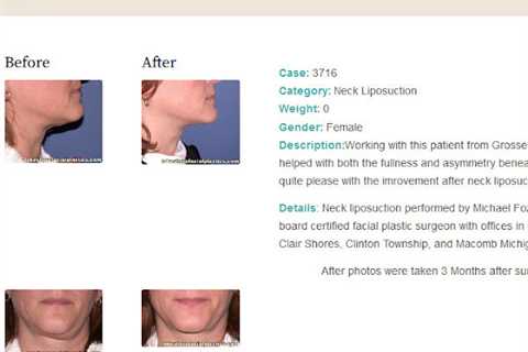 Lakeshore Facial Plastic Surgery