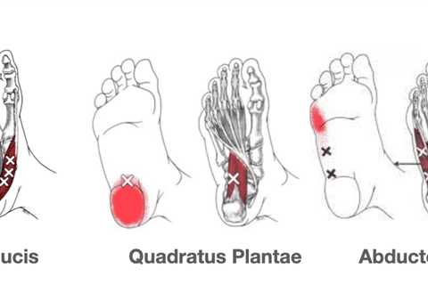 Self-Massage Techniques for Trigger Points in Your Feet