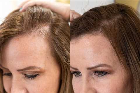 Hemp Oil For Hair Growth