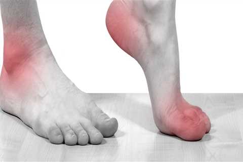 Does cbd help with neuropathy in feet?