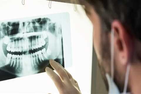 Where are dental x-rays developed?