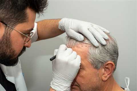 How Hair Transplant In Indore can Save You Time, Stress, and Money.