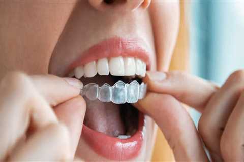 What Types of Dental Problems Can Be Treated with Invisalign?