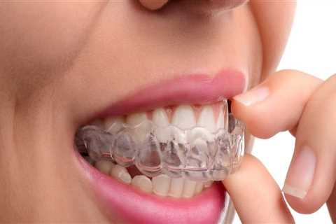Can I Eat and Drink with My Invisalign Clear Braces?