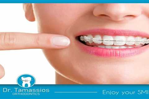 Standard post published to Tamassios Orthodontics - Orthodontist Nicosia, Cyprus at May 01, 2023..