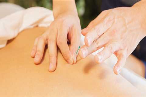 Acupuncture: An Overview of Alternative Treatments for Zoster Herpes