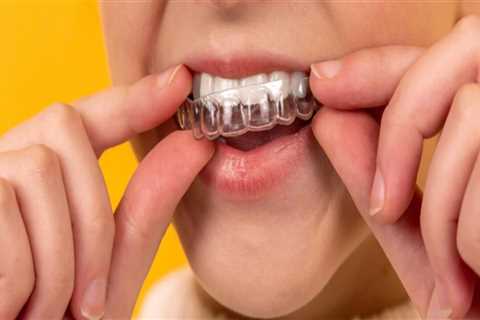 Why Invisalign Clear Braces Are A Popular Choice Among Sydney Residents