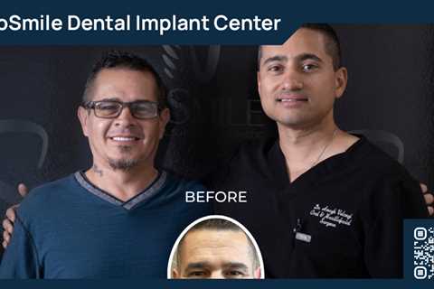 Standard post published to ProSmile Dental Implant Center at May 29, 2023 16:00