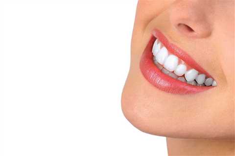 Nature's Smile Gum Balm A Natural Solution For Unhealthy Teeth & Gum - Repair Gums