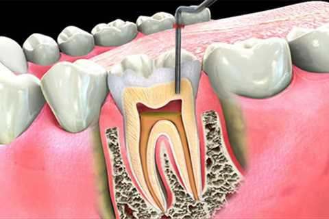 Standard post published to Symeou Dental Center at June 27, 2023 10:00