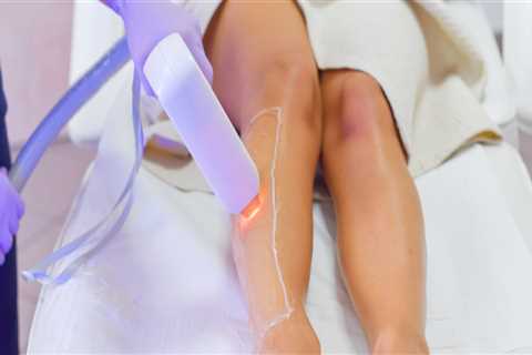 Does laser hair removal work everywhere?