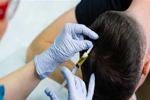 Hair Restoration In Beverly Hills: The Ultimate Guide For Reversing Hair Loss After Laser Hair..