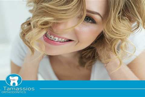 Standard post published to Tamassios Orthodontics - Orthodontist Nicosia, Cyprus at August 12, 2023 ..