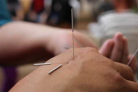 Acupuncture Training Programs