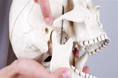 Understanding The Role Of Dental X-Rays In Treating Temporomandibular Joint Disorders In Spring, TX