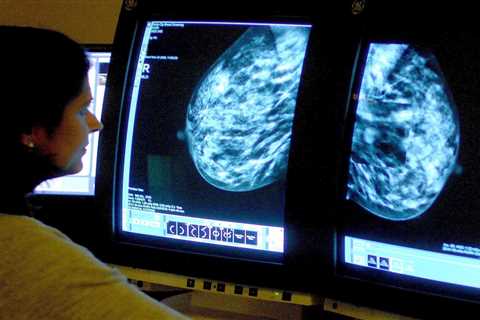 Thousands of Breast Cancer Cases Missed by NHS Screening, Campaigners Warn