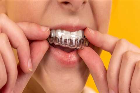 From Diet To Smile: Understanding The Role Of Clinical Nutrition In Invisible Aligner Treatment In..