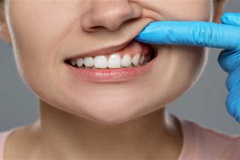 Is Periodontal Disease Reversible - Dental-Save