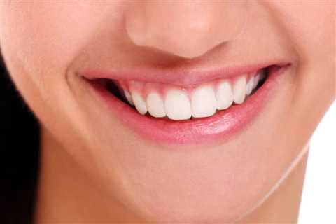Tooth Sensitivity After White Strips - Natures Smile Reviews